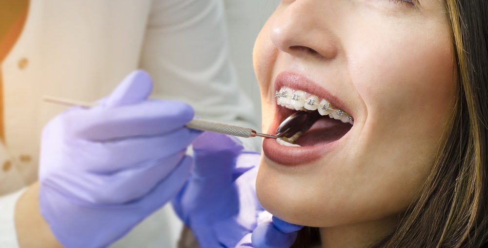 Wanneer-je-het-best-een-orthodontist-bezoekt